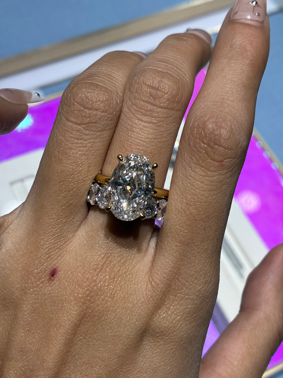 10ct oval with eternity band set